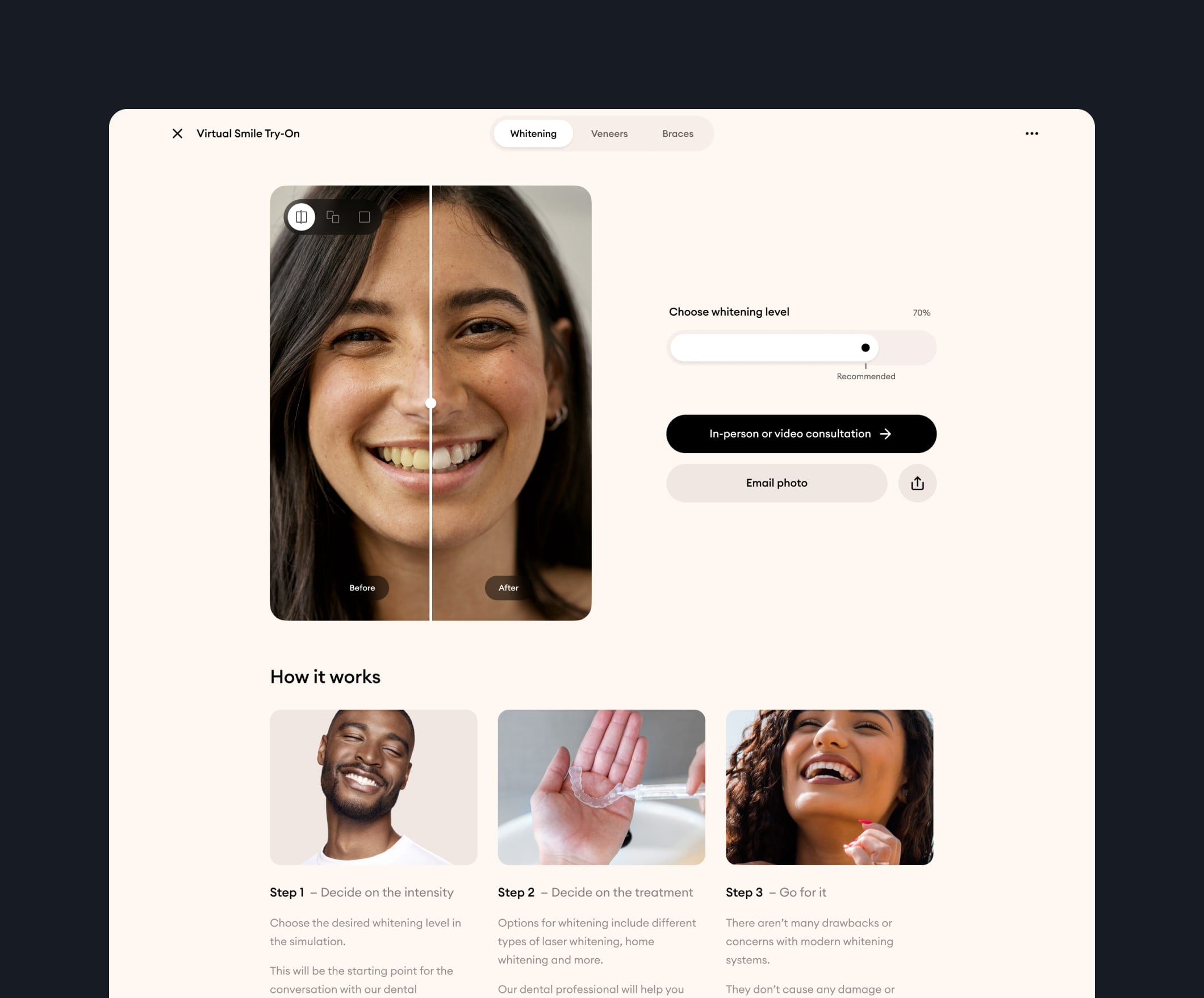 YSS — AI-powered virtual try-on for dental procedures