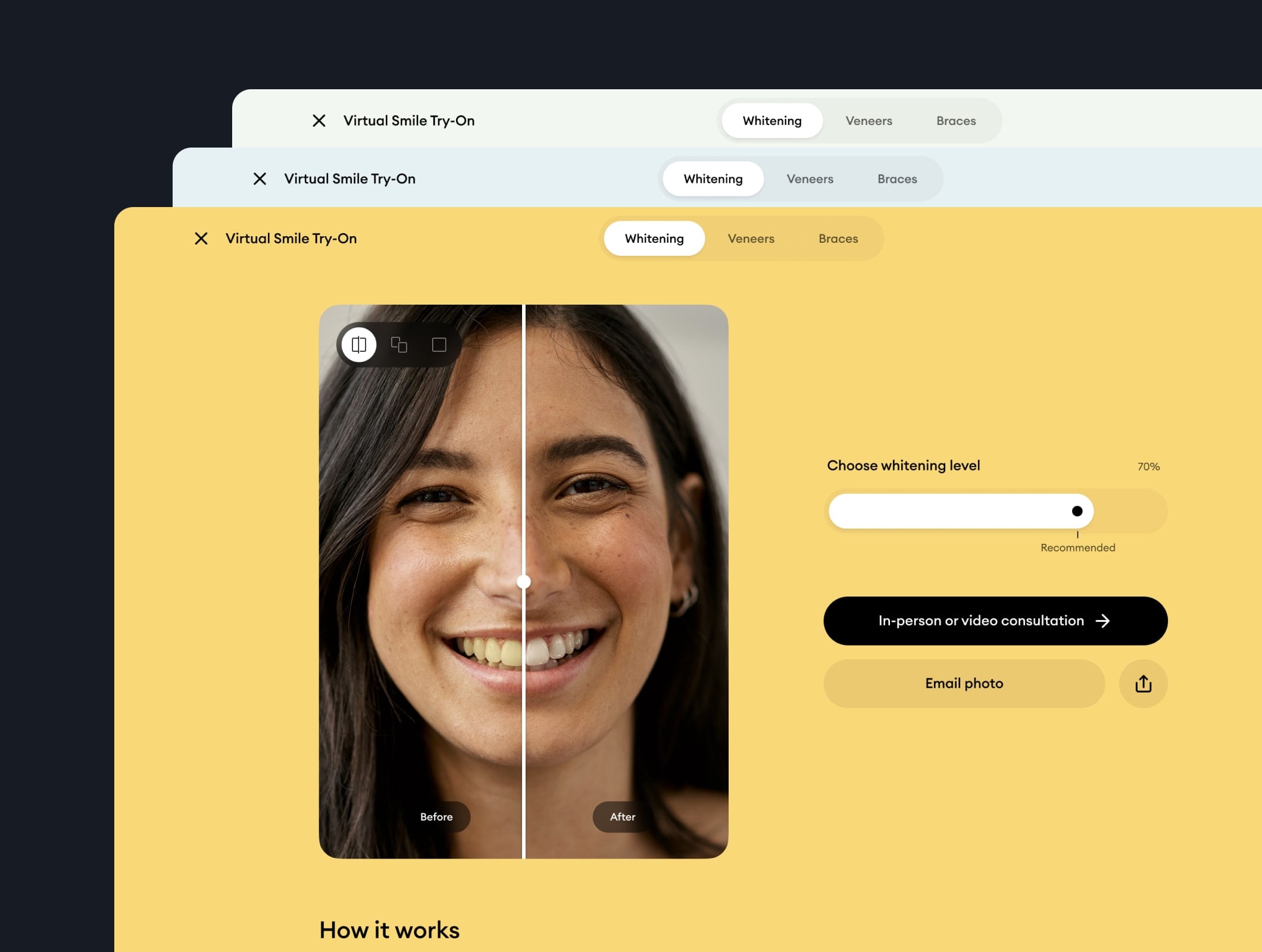 YSS — AI-powered virtual try-on for dental procedures
