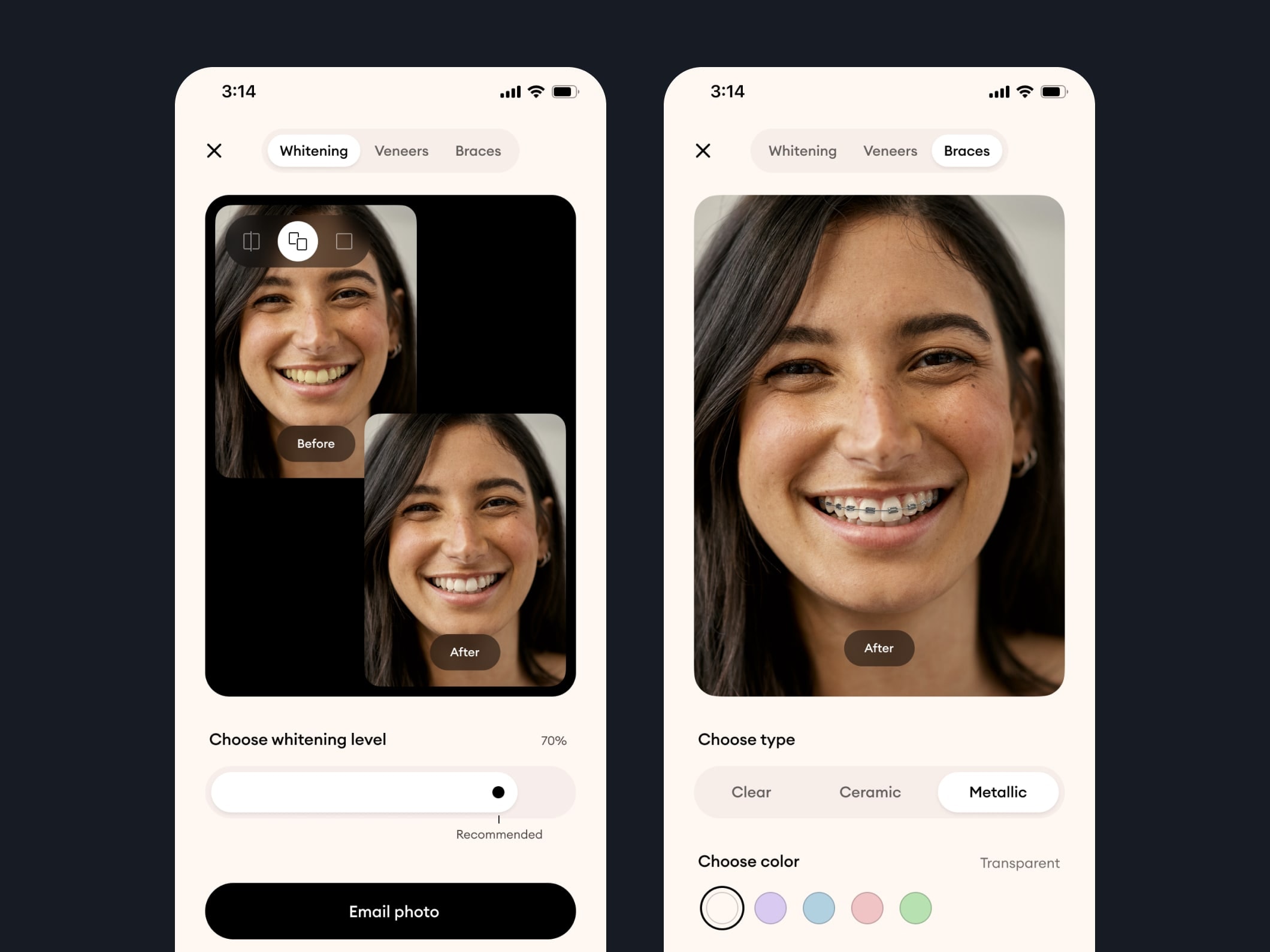 YSS — AI-powered virtual try-on for dental procedures